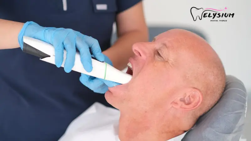 Digital Smile Makeover Antalya Turkey Digital Smile Makeover Antalya Turkey