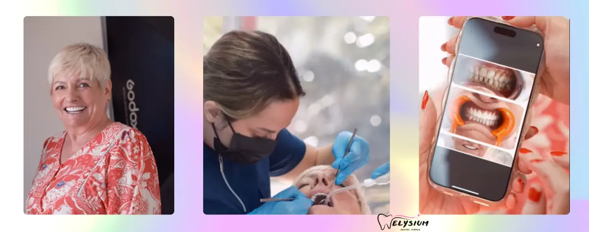 Affordable Dental Treatment Antalya Affordable Dental Treatment Antalya
