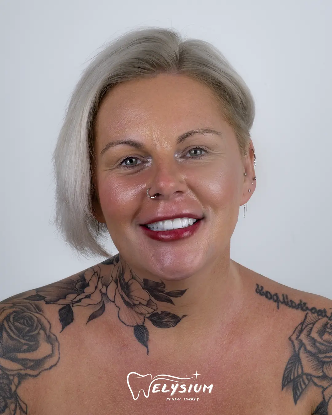 Elysium Dental Smile Gallery